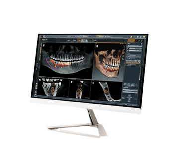Sirona Axeos CBCT