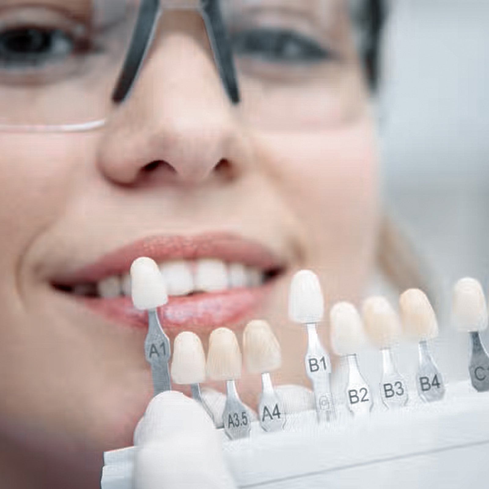 Philips Zoom! in-chair teeth whitening procedure at Arch Dentistry
