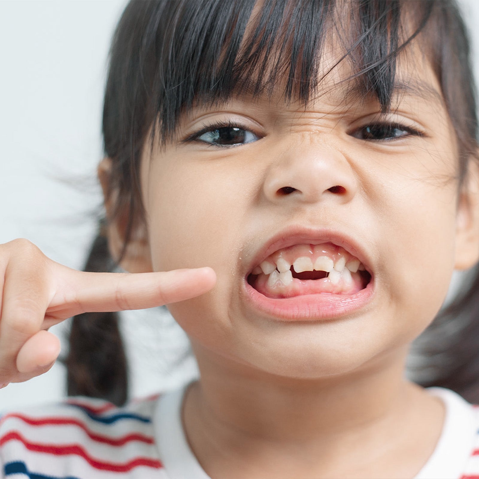 Why Baby Teeth Matter More Than You Think